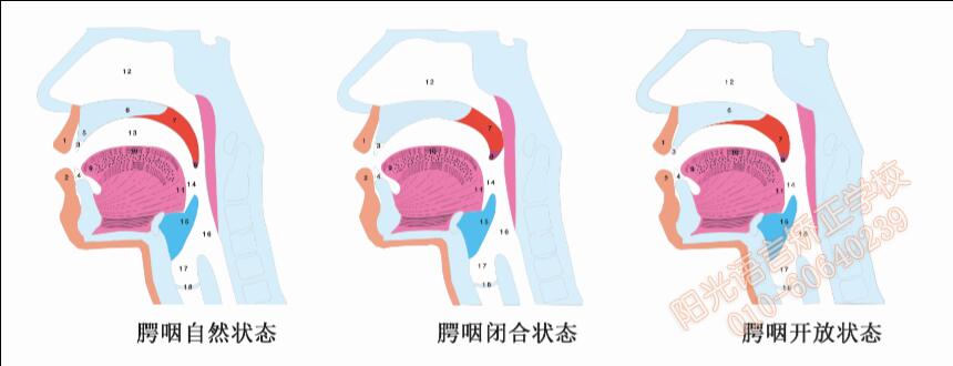 腭咽狀態